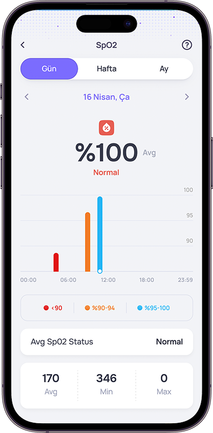 Ring phone preview